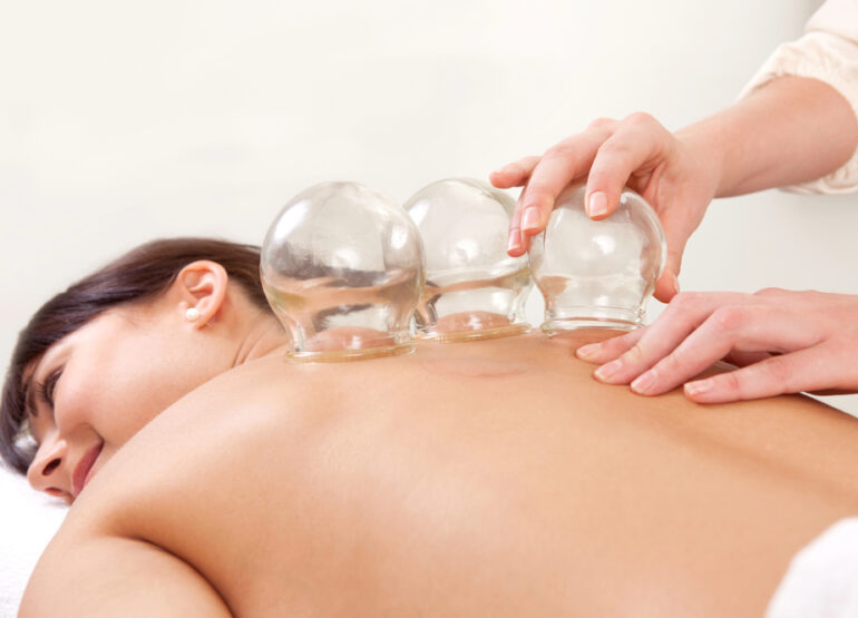 Exploring Cupping Therapy Benefits for Mental Health Treatment